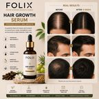 FOLIX Hair Growth Serum (50ml)